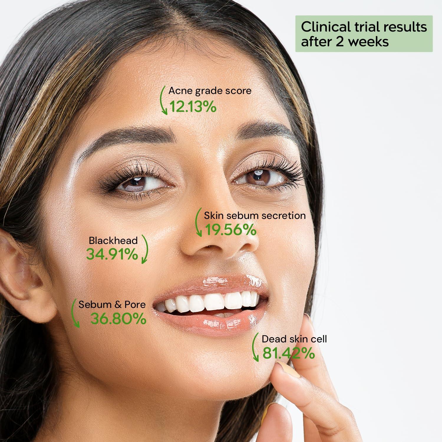 tHermoCEUTICAL tHermoCEUTICAL DeAC Aciderm Solution - Acne Skin Care, Sebum & Dead Skin Cells Control, Pore Reduction, Acne Grade Down, Skin Trouble Treatment, Fast Absorbing 0.5 fl.oz