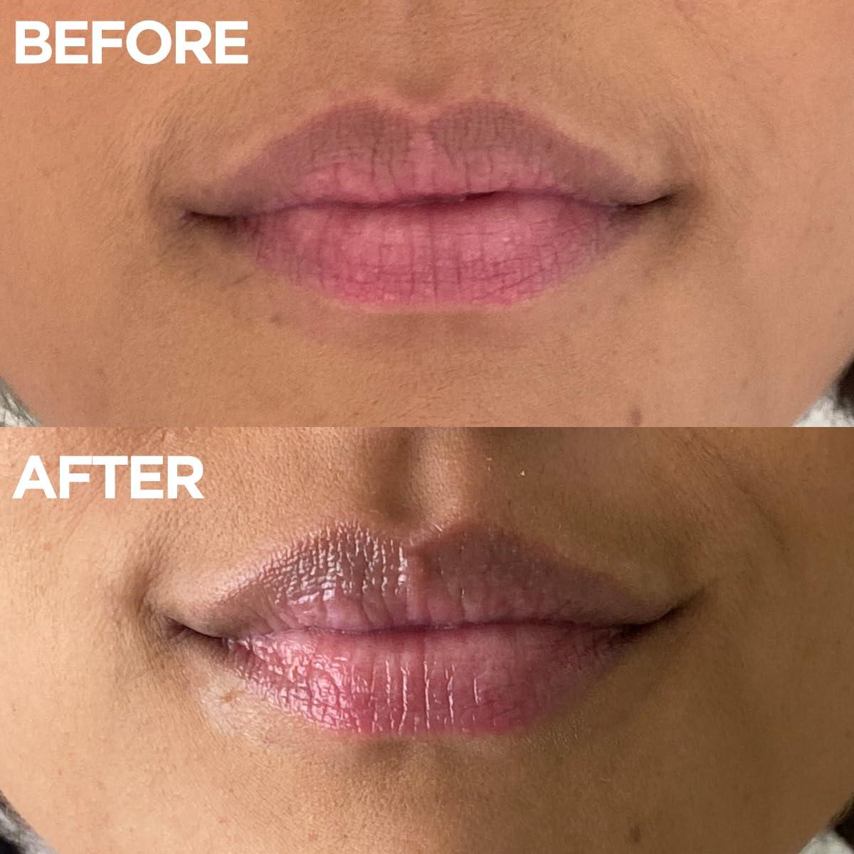 Lanolips Lanolips Golden Dry Skin Salve - Lanolin Oil Healing Ointment with Vitamin E & Manuka Honey - Body Moisturizer for Dry Skin - Relief for Dry Hands & Cracked Lips - Dermatologist Tested (25g)