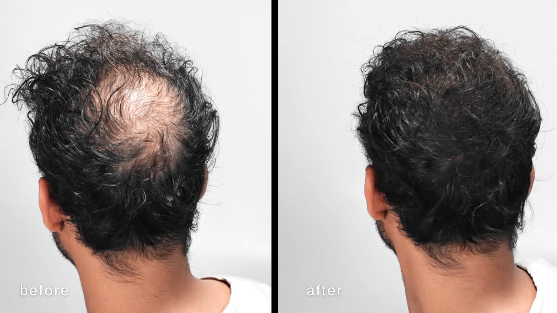 LUXE Professional LUXE Hair Thickening Fibers - CONFIDENCE IN A JAR – 2 Months+ Supply! – Hypoallergenic, Dermatologist Tested – Multiple Colors Available (Dark Brown)