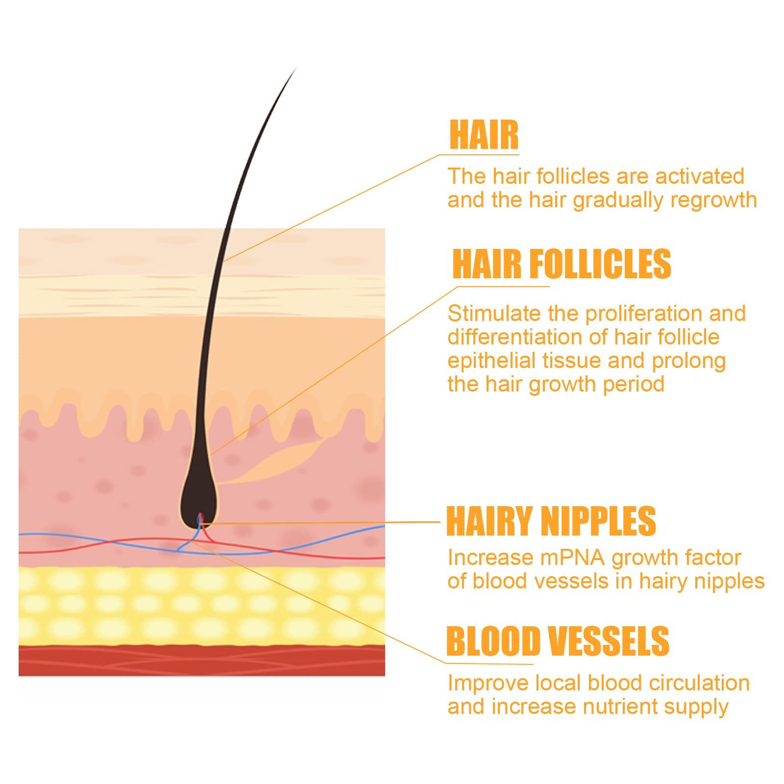 QINGTING 500ml Instant Ginger Hair Regrowth Shampoo, Ginger Shampoo, Ginger Shampoo for Hair Growth, Ginger Shampoo Hair Thickening Shampoo, Anti-Hair Loss (Shampoo)