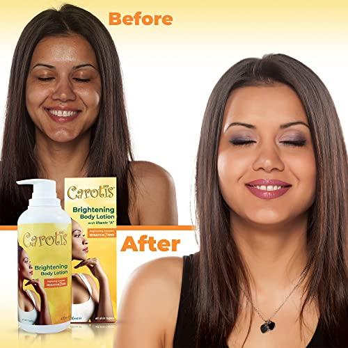 carotis Carotis, Skin Brightening Lotion - 13.5 Fl oz / 400ml |For Body, Knees, Elbows, Hands, with Carrot Oil and Vitamin A
