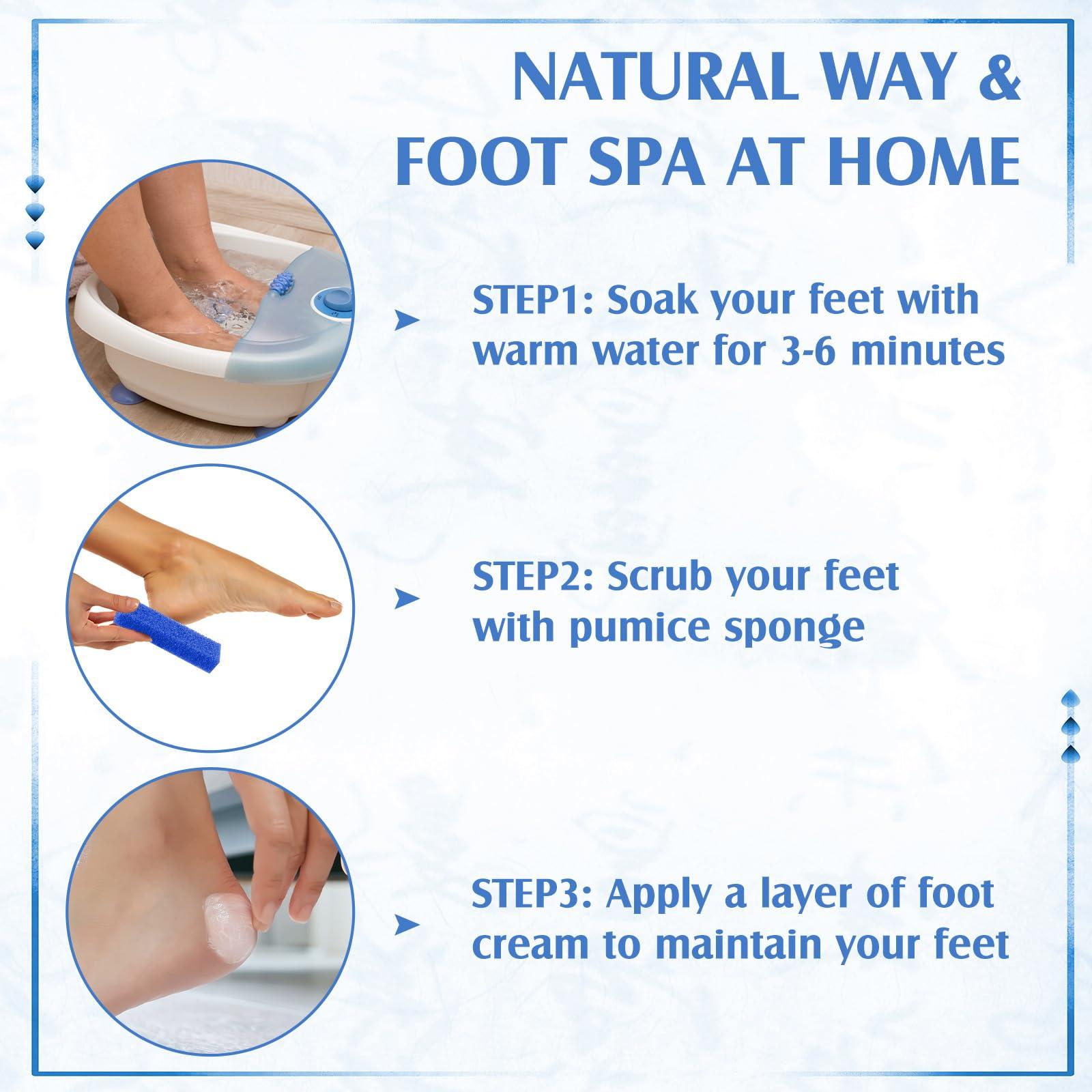 Batiyeer Batiyeer 100 Pcs Pumice Stone for Feet Scrubber Dead Skin Disposable Foot Pumice Foot Shower Scrubber Foot Scrubber for Heel Cuticle Callus Remover Bath Spa (Blue)