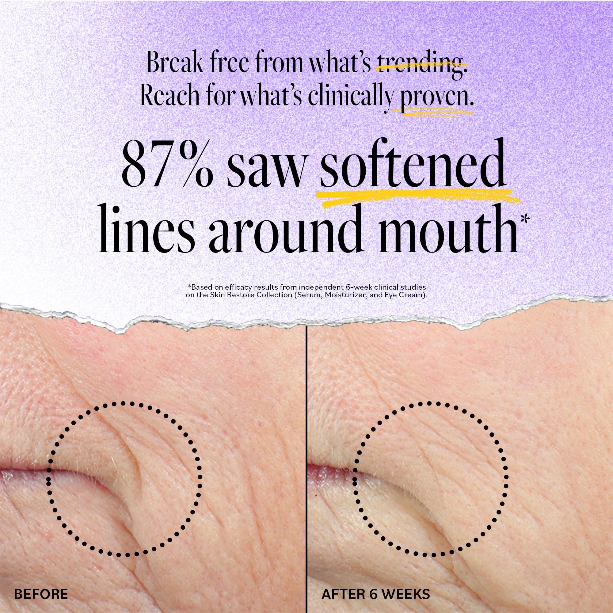 Derma E DERMA-E Advanced Peptides and Vegan Flora-Collagen Moisturizer Double Action Collagen Face Cream with Peptide Complex Intensely Hydrating Face Moisturizer for Lines, Wrinkles and Redness, 2 Oz