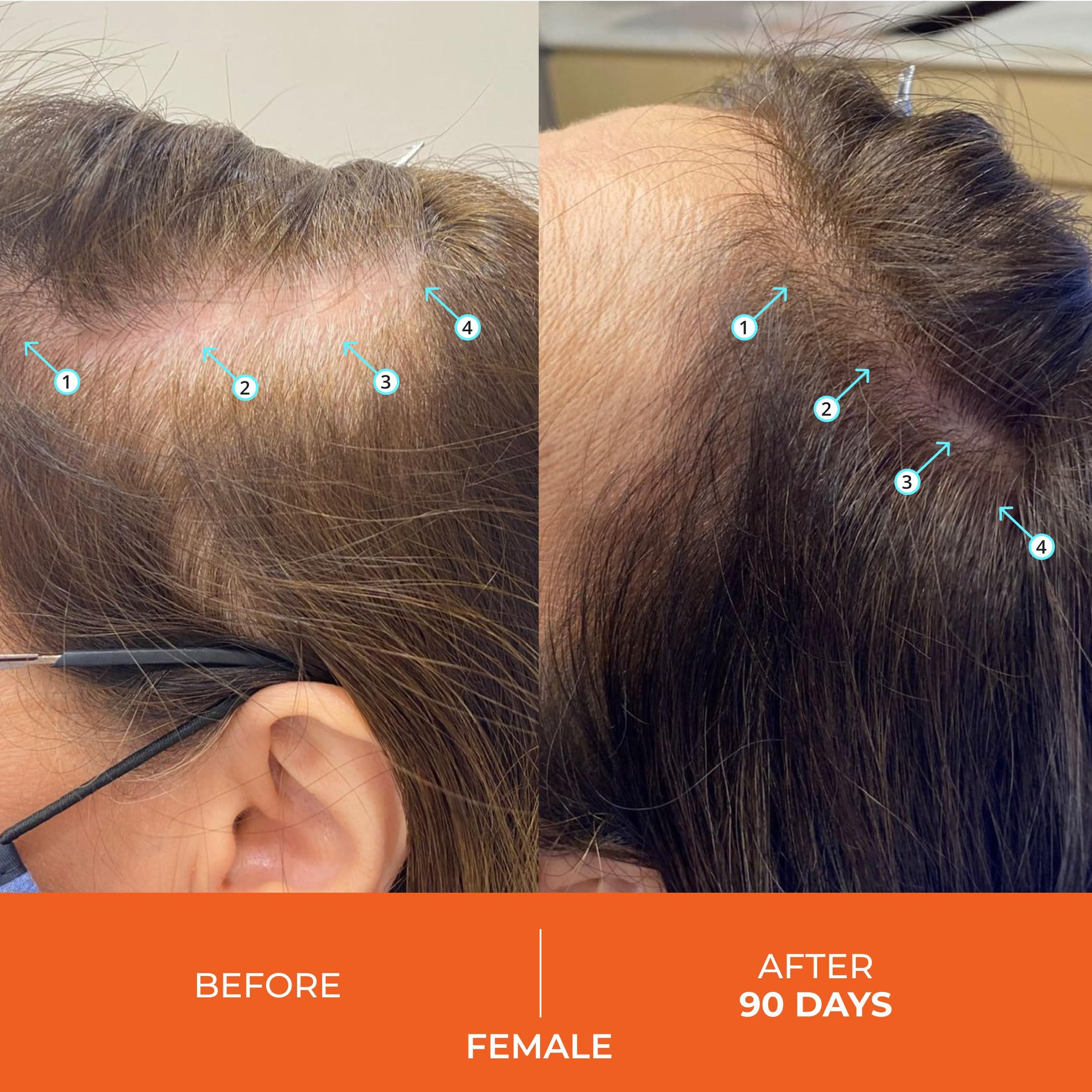 DS LABORATORIES DS Laboratories Revita Shampoo and Conditioner Set, Hair Thickening Shampoo and Conditioner to Support Hair Growth, Sulfate Free Shampoo and Conditioner with Biotin, Caffeine & DHT Blocker, Hair Care