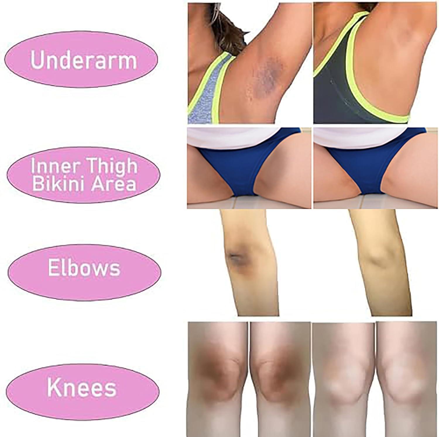 Ceavo Skin Whitening Cream Skin Bleaching Cream for Body Intimate Area, Private Parts, Underarm, Knees, Elbows, Inner Thigh, Bikini Areas, Bikini Line, Lightening Cream Dark Spot Remover For Intimate Areas