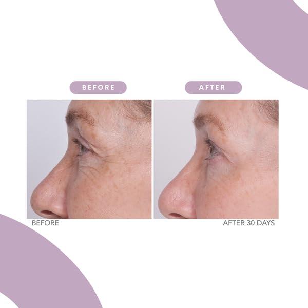 Serious Skincare Serious Skincare - Reverse Lift Eye Cream Moisturizer with Peptides - Skin Firming Wrinkle Formula - Temporarily Lift & Firm Eye Lids and Eye Area Women, Men - 1 Fl. Oz.