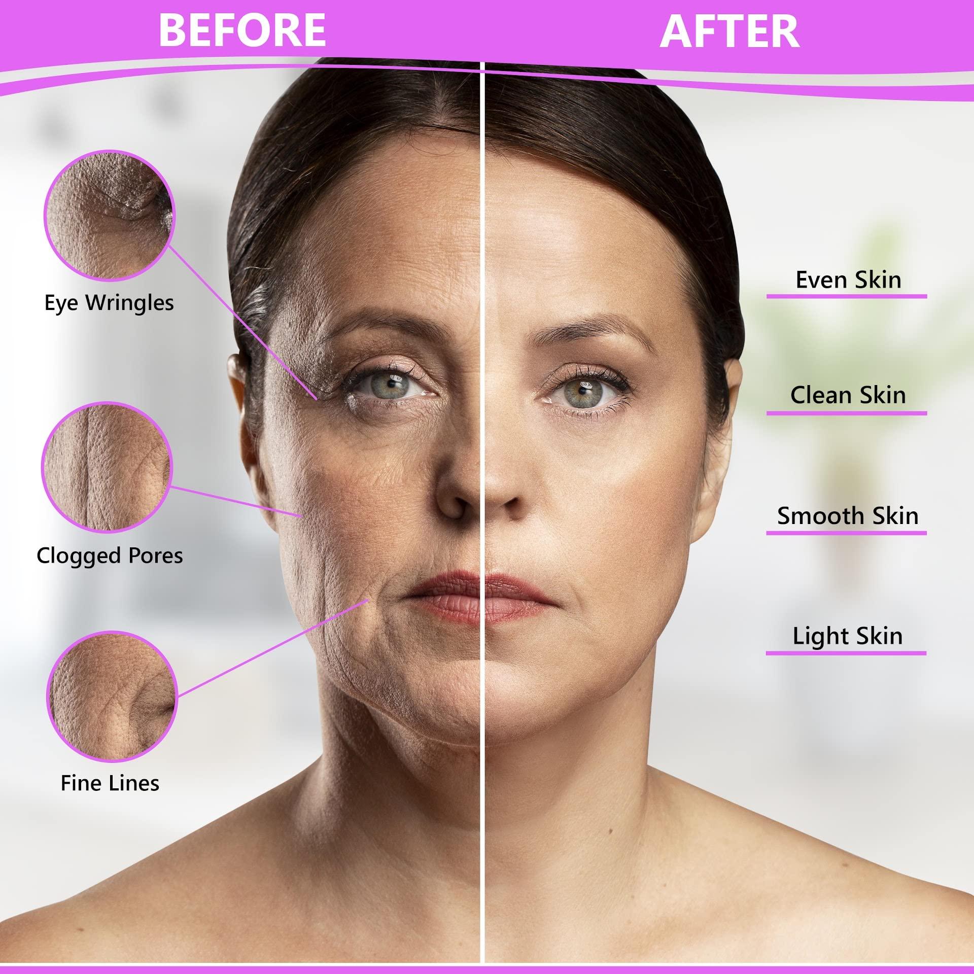 Dermal-Tech Dermal-Tech Light Therapy Face Mask Rejuvenation FDA Cleared PDT LED Facial Red Light Therapy Face & Neck Lift & Tightening Machine, Anti Aging, Dark Spot Remover Device (Flexible Silicom)