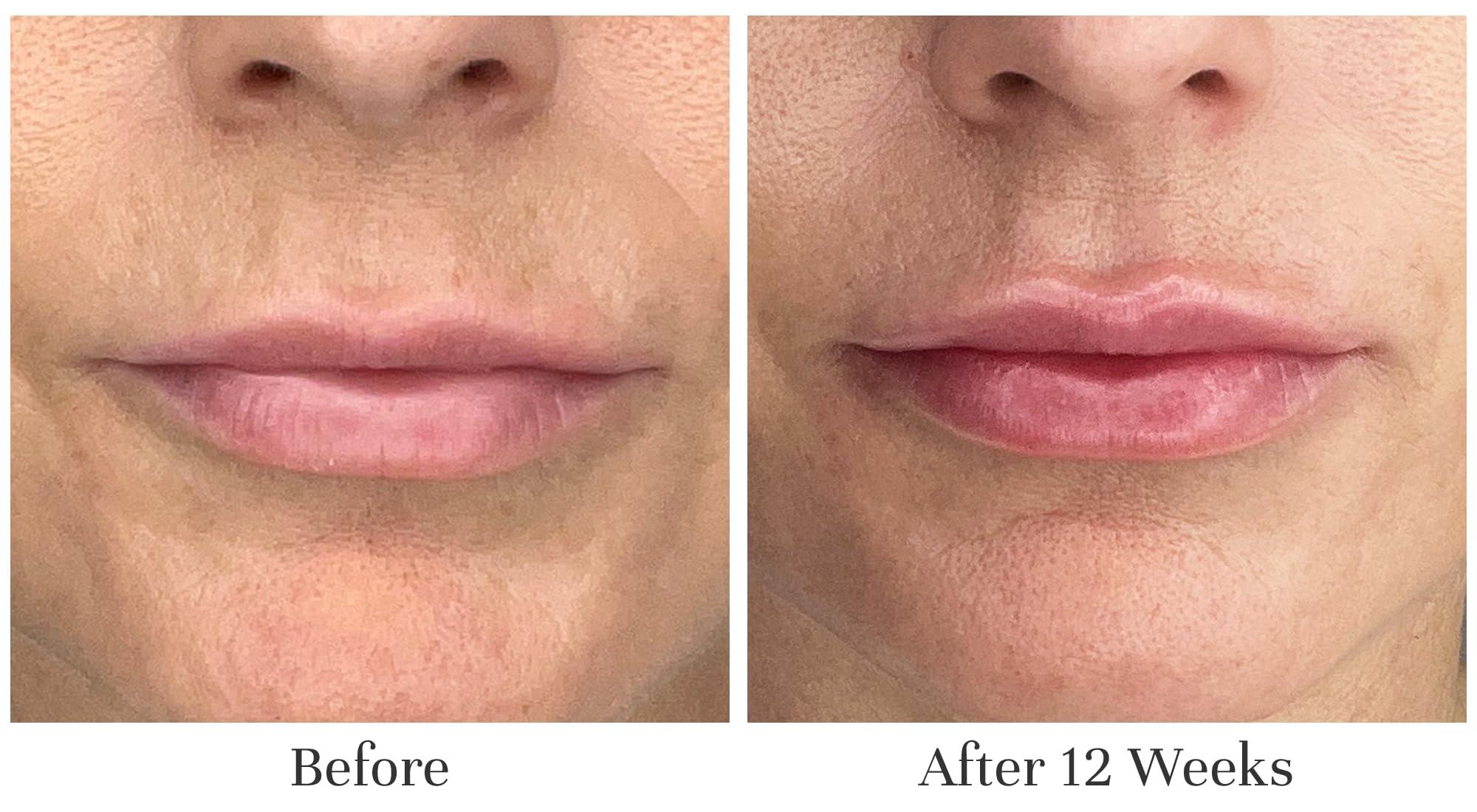 City Beauty City Beauty Day & Night Lip Plumping Duo - City Lips Clear 0.16 fl oz + City Lips Night Oil 0.23 fl oz, Advanced Hydration & Anti-Aging Formula: Fuller, Smoother, Younger-Looking Lips