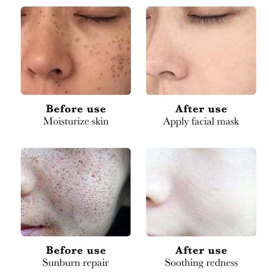 BEROZA Crema para Manchas Oscuras en La Cara, Esencia de manchas oscuras en la cara, 30ML Vitamin C&E Face Moisturizer Serum for Women (3pcs)