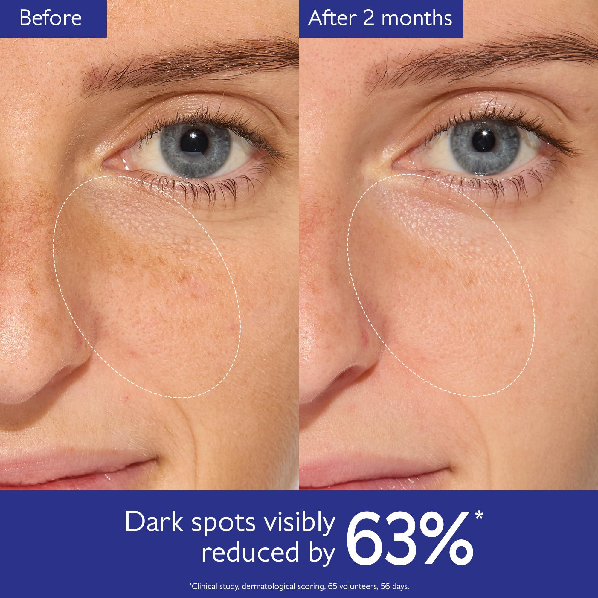 Caudalie Caudalie Vinoperfect Brightening Dark Spot Serum Vitamin C Alternative - Jumbo Size 62x More Effective than Vitamin C with Viniferine for a Visibly Brighter Even Complexion