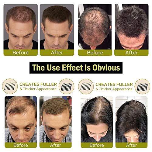 BIERDAN BIERDAN Fluff Up Secret Hair Fibers Powder,Hair Powder for Thinning Hair for Women,Hair Filler Powder for Men and Women,for Instantly Cover Sparse Hair,Hair Fiber Powder Waterproof