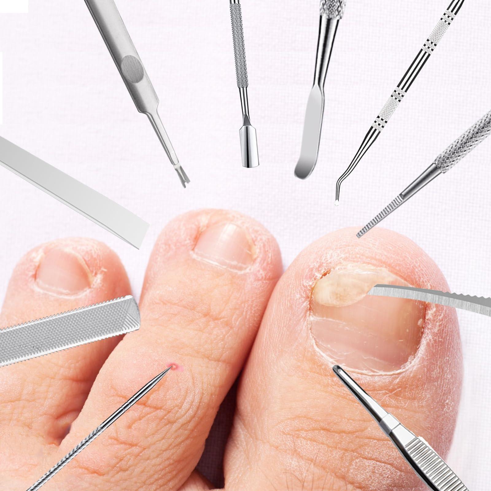 TOESCARE 11pcs Ingrown Toenail Tool Kit - Professional Ingrown Toenail Removal Kit for Podiatry Kit and Pedicure - Toenail Ingrown Correction Complete with Ingrown Toenail File Lifter, Sidewall Cleaner