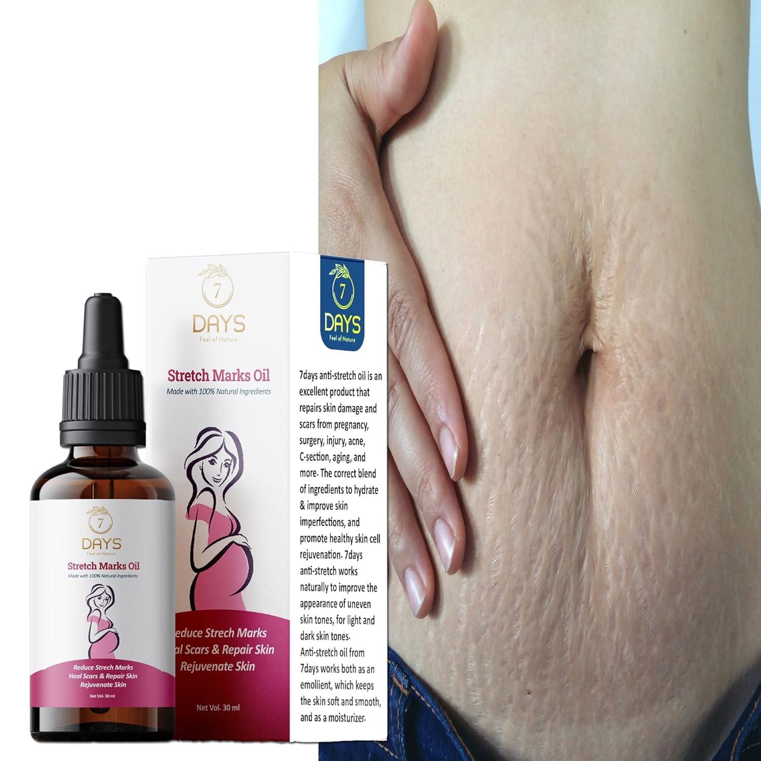 Generic Natural Stretch Mark Removal Cream 30 ml