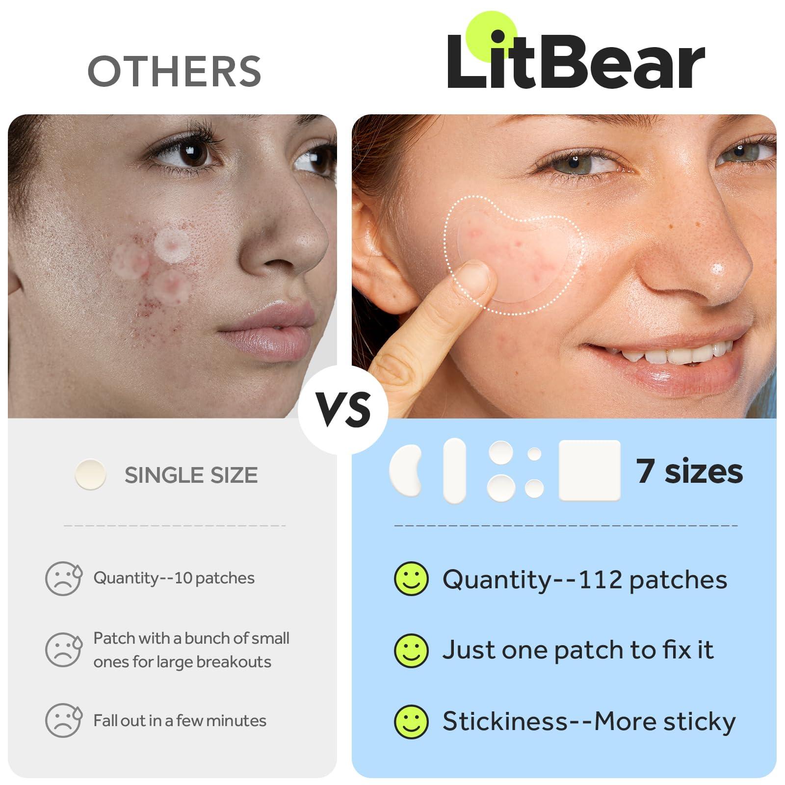 LitBear LitBear Large Pimple Patches (7 Sizes 112 Patches), Big Acne Patches, XL Hydrocolloid Bandages for Full Face, Forehead, Chin, Nose, Body, Back, Neck & Chest, Oval, Moon, Square hydrocolloid Patch