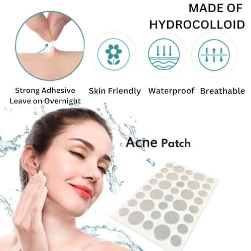 MELICAN MELICAN Pimple Patches for Face 180 Count - Acne Patches for Face - Hydrocolloid Large Zit Patches - 2 Size Pimple Patch 8mm, 12mm