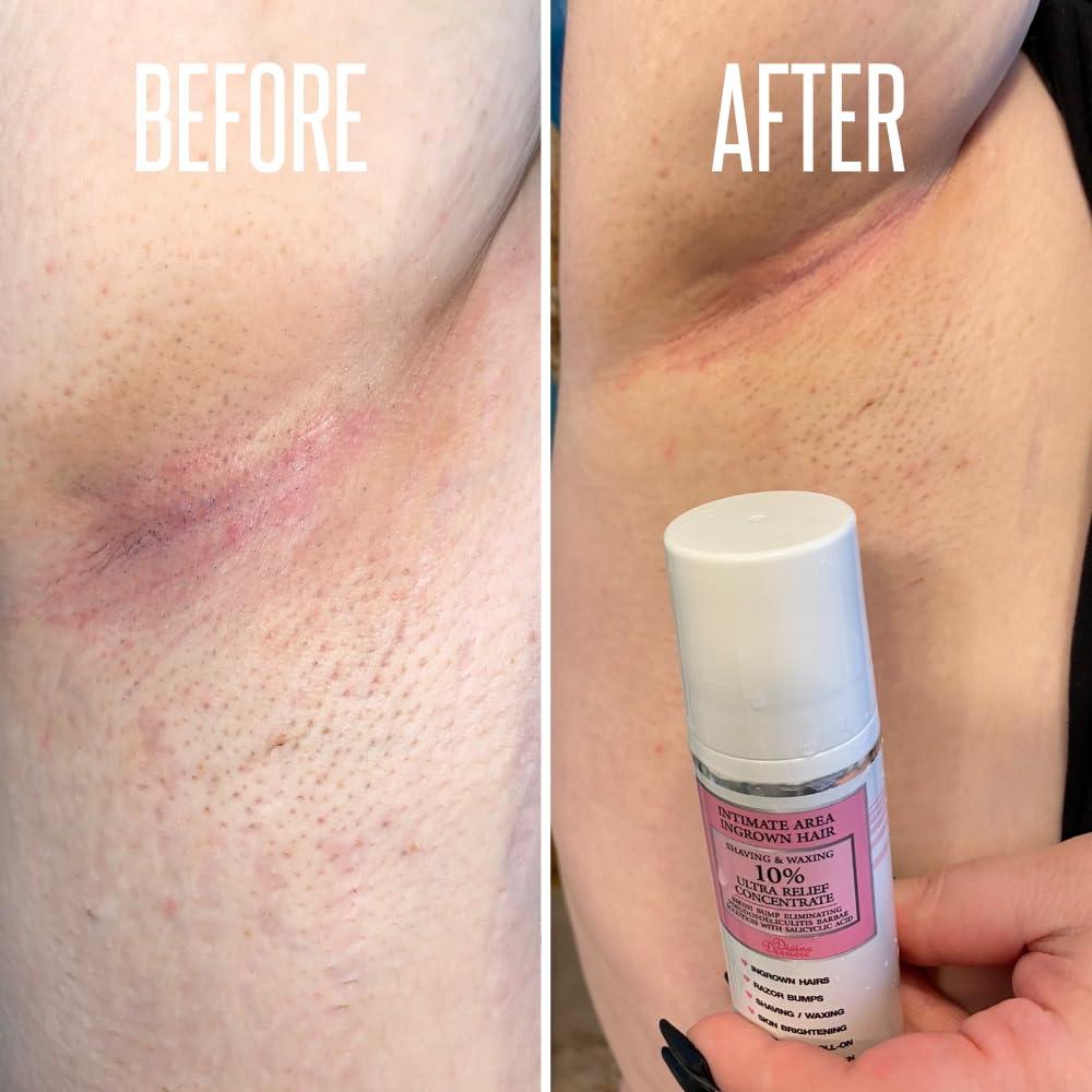 Divine Derriere Intimate Skin Lightening Gel for Body and Bikini Area & Ingrown Hair Eliminator Serum Provides the Most Effective Combination For Fading Dark Spots & Removing Ingrown Hairs