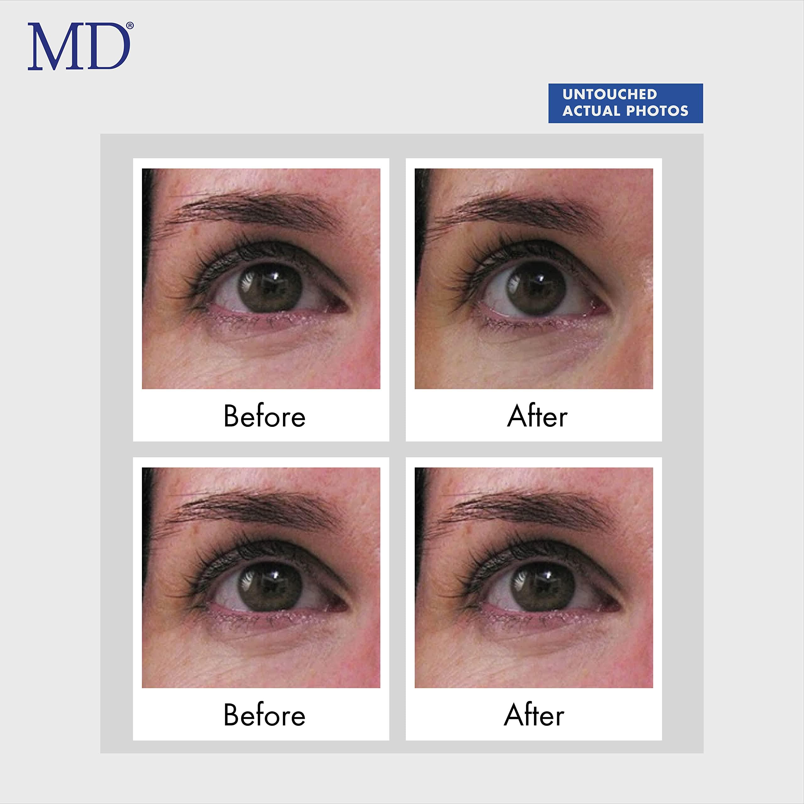 MD Lash Factor MD Ultimate Eye Cream Under Eye Cream for Reduced Dark Circles, Puffiness, Wrinkles, Bags & Anti-Aging Enriched with Collagen, Peptides, Shea Butter for Firmness, Lifting & Moisturization