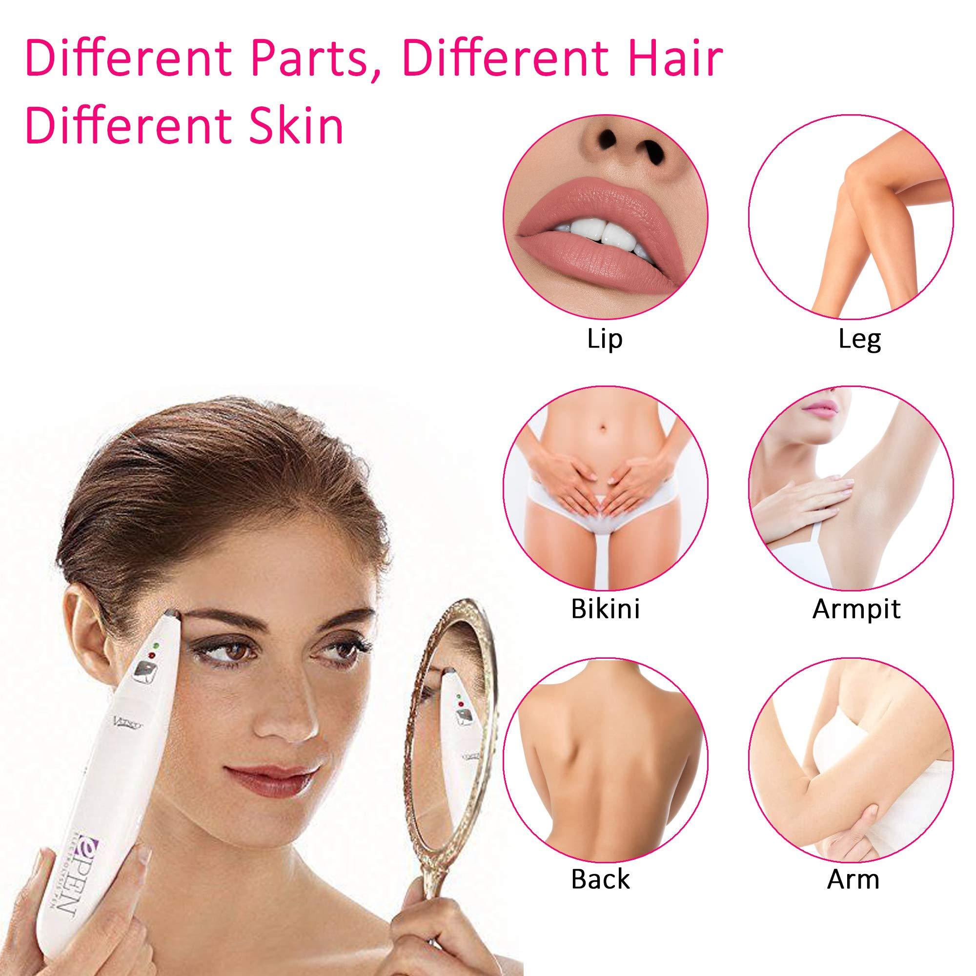 Verseo Verseo ePen Permanent Hair Removal Needle-Free Electrolysis Pen System for Unwanted Hair Removal from Face, Underarm, Bikini Line and so much more for men and women who value their privacy