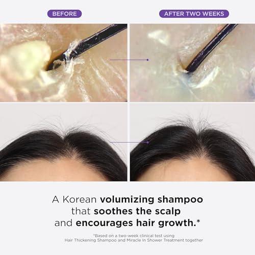 Dr. Groot Dr. Groot Hair Thickening Shampoo, Korean Hair Care with Biotin, Rosemary Oil to help Volumize Thinning, Damaged Hair, Hydrate Hair and Scalp, Biotin Shampoo,Scalp Revitalizing Solution