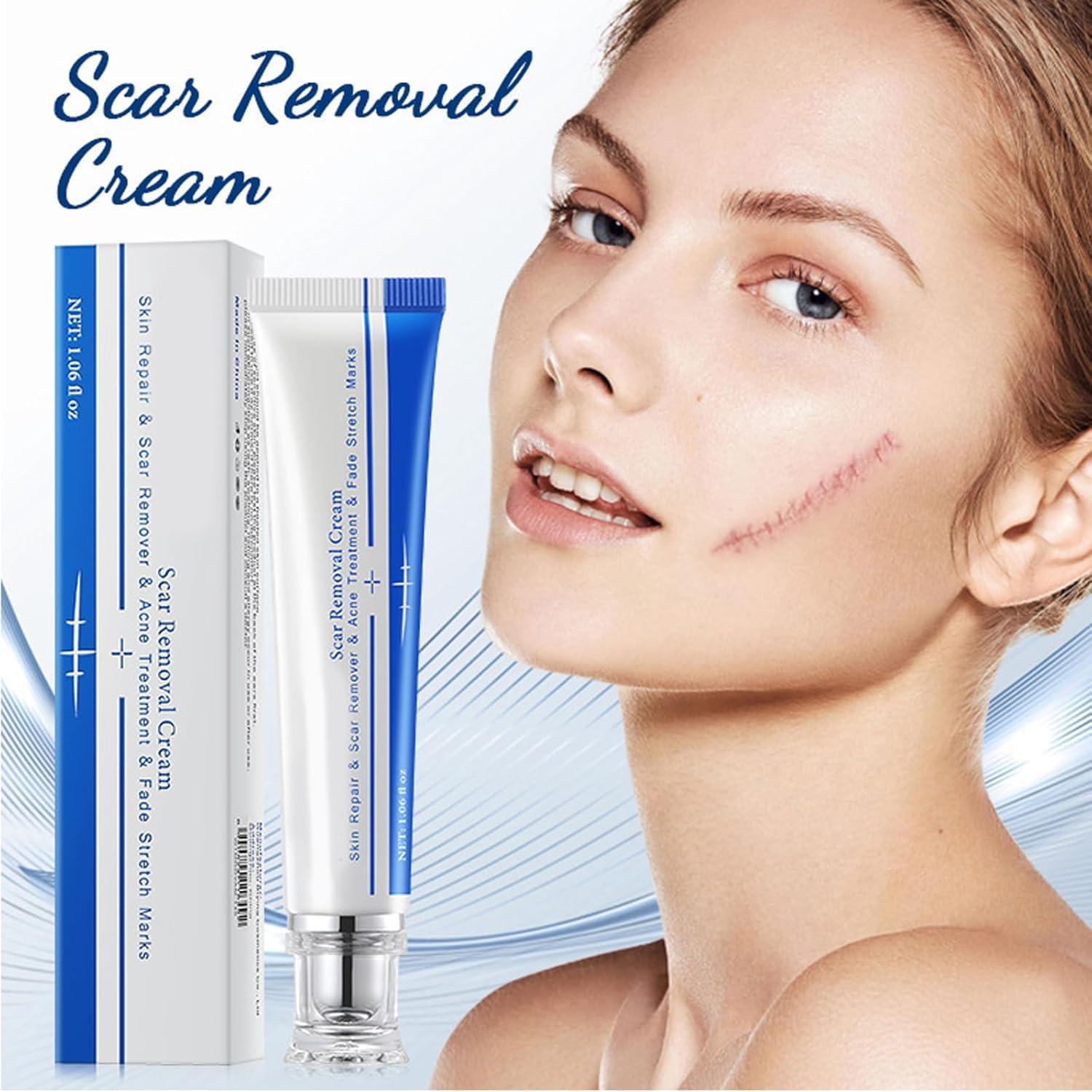 Generic Advanced Scar Cream Gel, Scar Removal Cream for Skin Face Body, Medical-Grade Silicone Gel Treatments for Keloid C-Section Acne Surgical Burns Stretch Marks - Old and New Scars 1.0 oz (1 PCS)