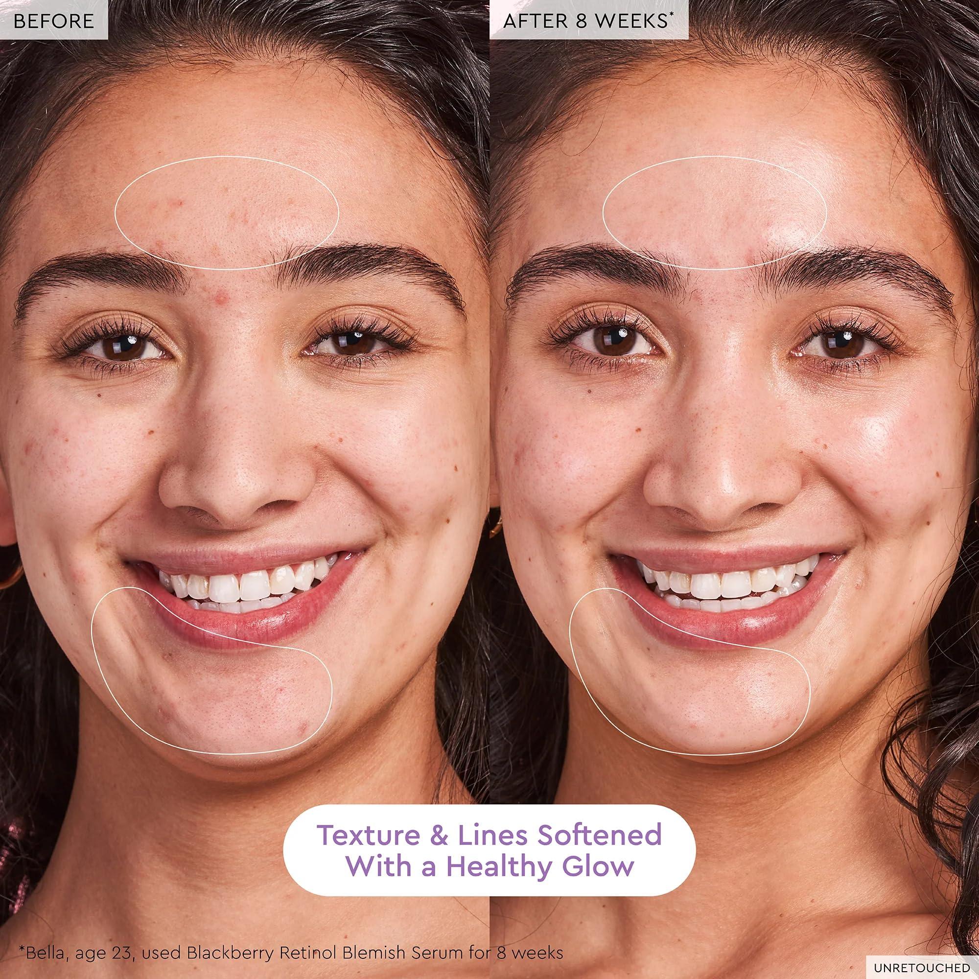 Glow Recipe Glow Recipe Gentle Blackberry Retinol Night Serum - Anti Aging Korean Face Serum for Sensitive Skin + Hydrating Triple Retinoids & Glycerin to Clarify Blemishes, Smooth Texture, Lines & Wrinkles, 30ml