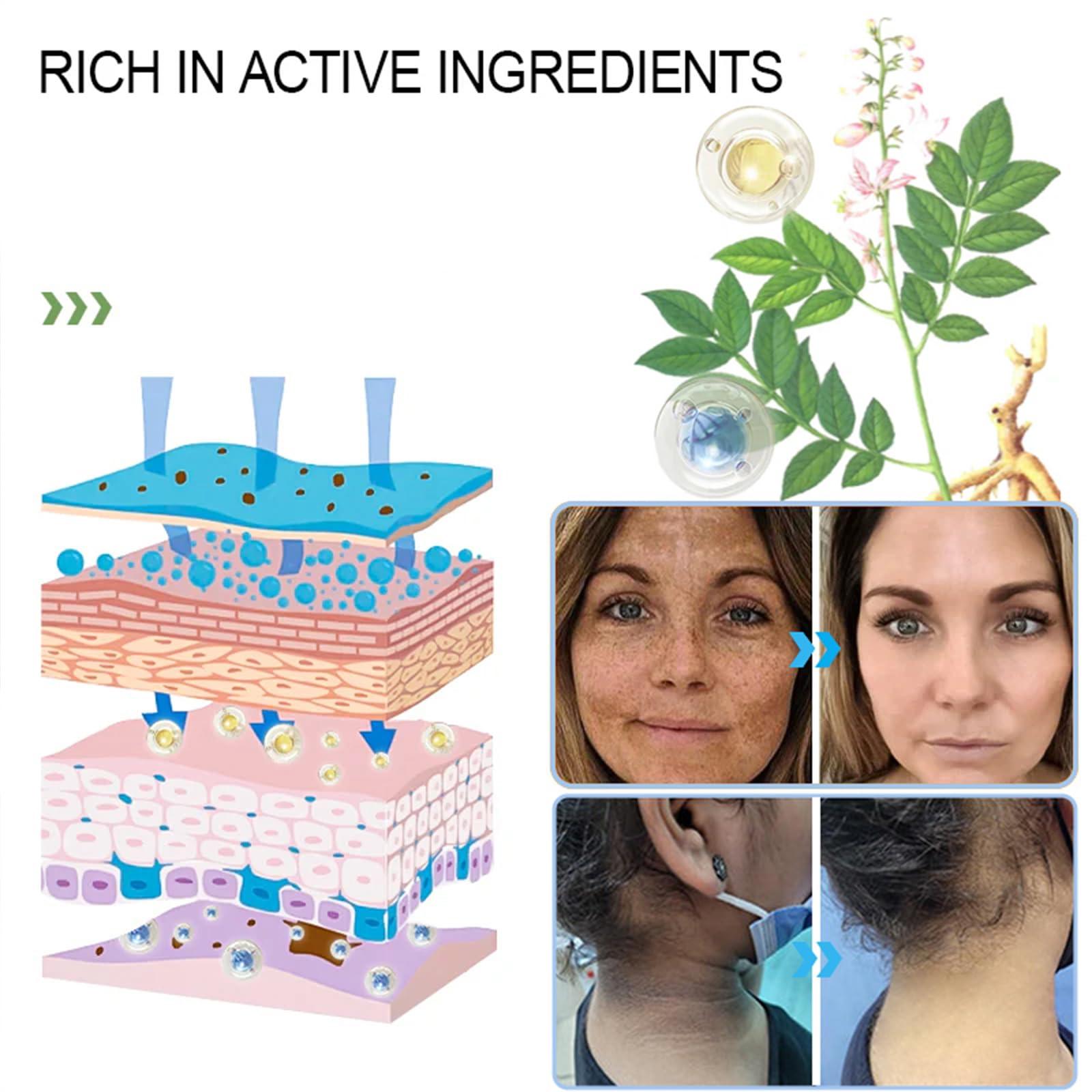 Luhaka JORONDY Purifying Peel Gel, purifying peel, deep cleans and moisturizes the skin, effective exfoliation