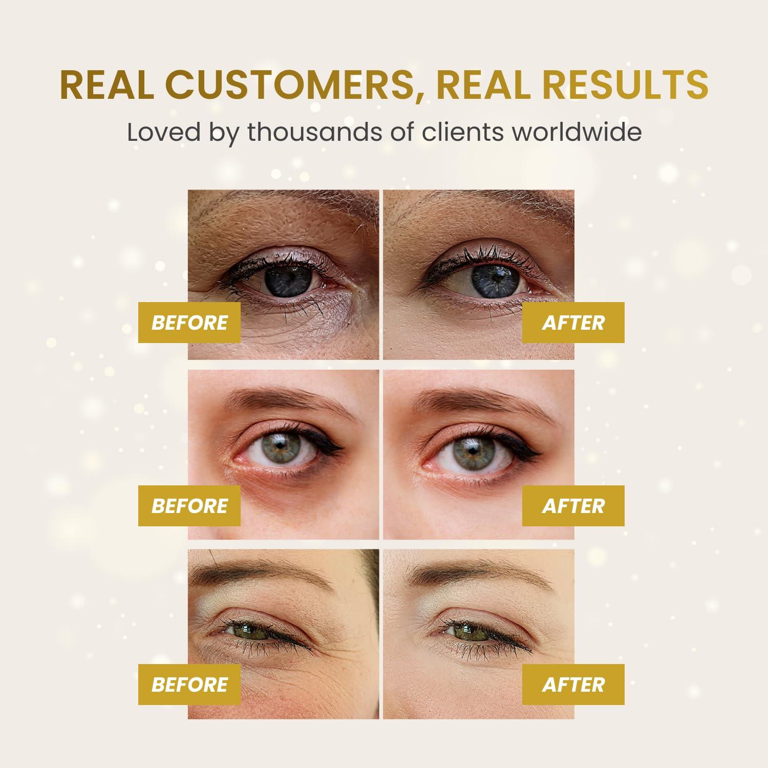 PLANTIFIQUE PLANTIFIQUE Gold Under Eye Patches for Puffy Eyes and Dark Circles 5 Pairs Under Eye Masks for Dark Circles and Puffiness Eye Gels with Collagen & Caffeine Eye Patches Gold Eye Mask Skincare