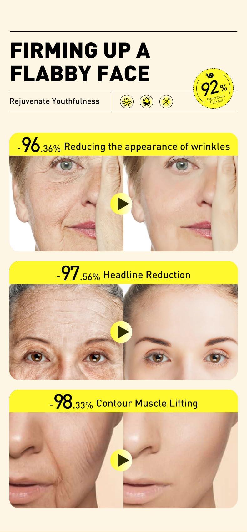 SORYA Advanced Snail Mucin 92% Face Cream Snail Moisturizer Powerful Anti Aging Blemishes for Deep Hydration, Skin Repair, and Wrinkle Reduction