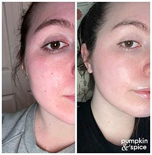 Pumpkin And Spice Pumpkin Spice Clay Enzyme Facial Mask | Removes Pimples, Minimizes Pores, Blackheads, Wrinkles, Breakouts | Hydrates, Tightens, Brightens | Organic Pumpkin Seed Oil Dermal Body Purifying | 50g