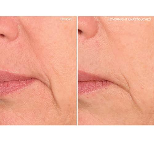 SiO SiO Beauty Eye & Smile Lift | Eye & Smile Anti-Wrinkle Patches 2 Week Supply | Overnight Smoothing Silicone Patches for Wrinkles and Fine Lines