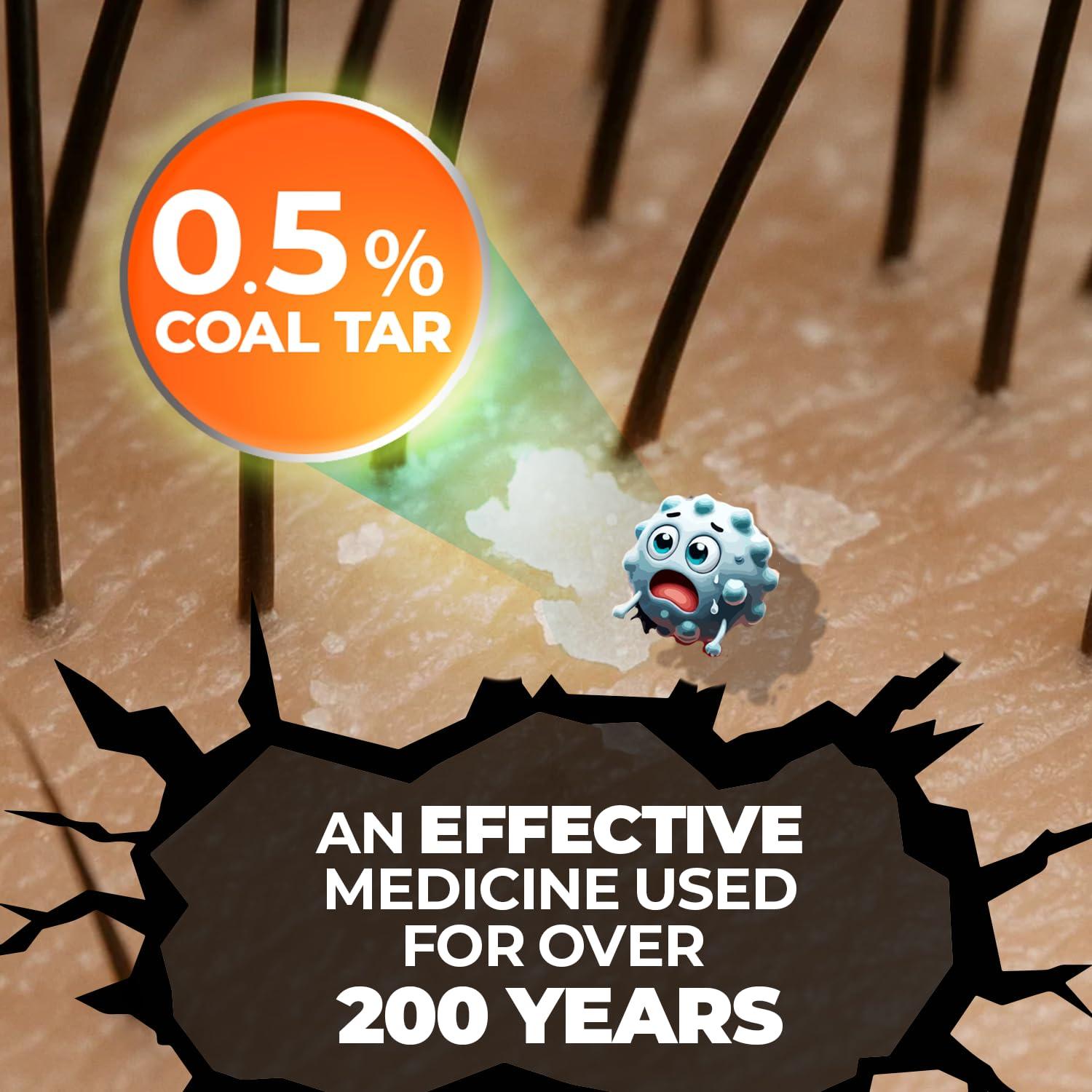 Medicasp Medicasp Coal Tar Gel Anti Dandruff Shampoo, Treats Seborrheic Dermatitis & Psoriasis, Formulated for Dry, Flaky & Itchy Scalp Treatment, for Women & Men, 6 Ounce (Pack of 2)