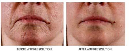 Dr.Sevinor Skincare Solutions Dr Sevinor Wrinkle Solution Wrinkle Smoothing Tinted Serum 1 FL OZ