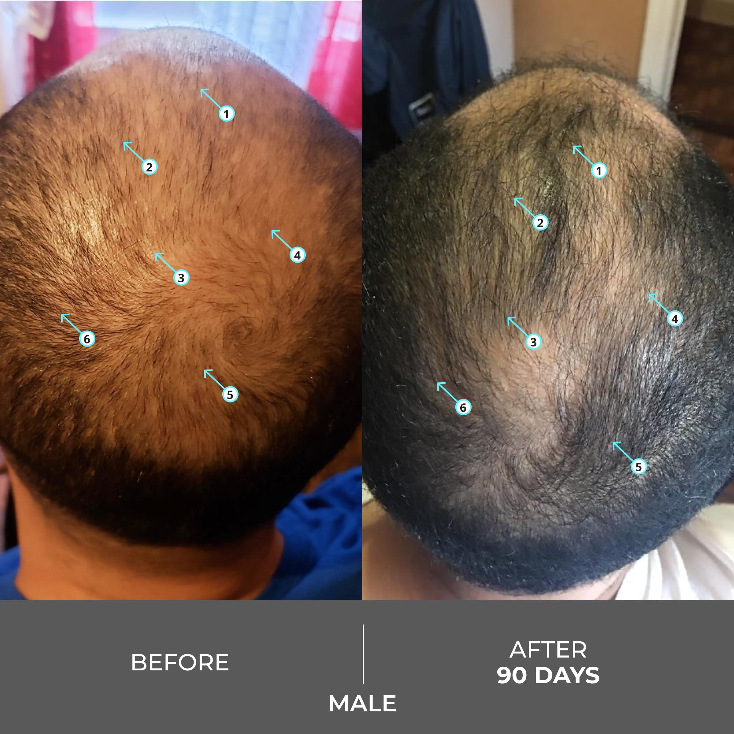 DS LABORATORIES DS Laboratories Revita Extra Strength Shampoo - Hair Growth Shampoo Hair Strengthening Shampoo DHT Blocker for Men & Women Sulfate Free Biotin Shampoo