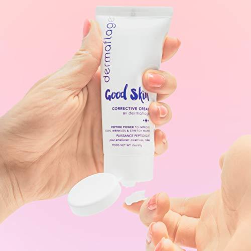 Dermaflage Dermaflage Acne Scar Removal Cream With Peptide Power, Fade Acne, Surgical Scars, Stretch Marks And Wrinkles With Good Skin, 2 oz.