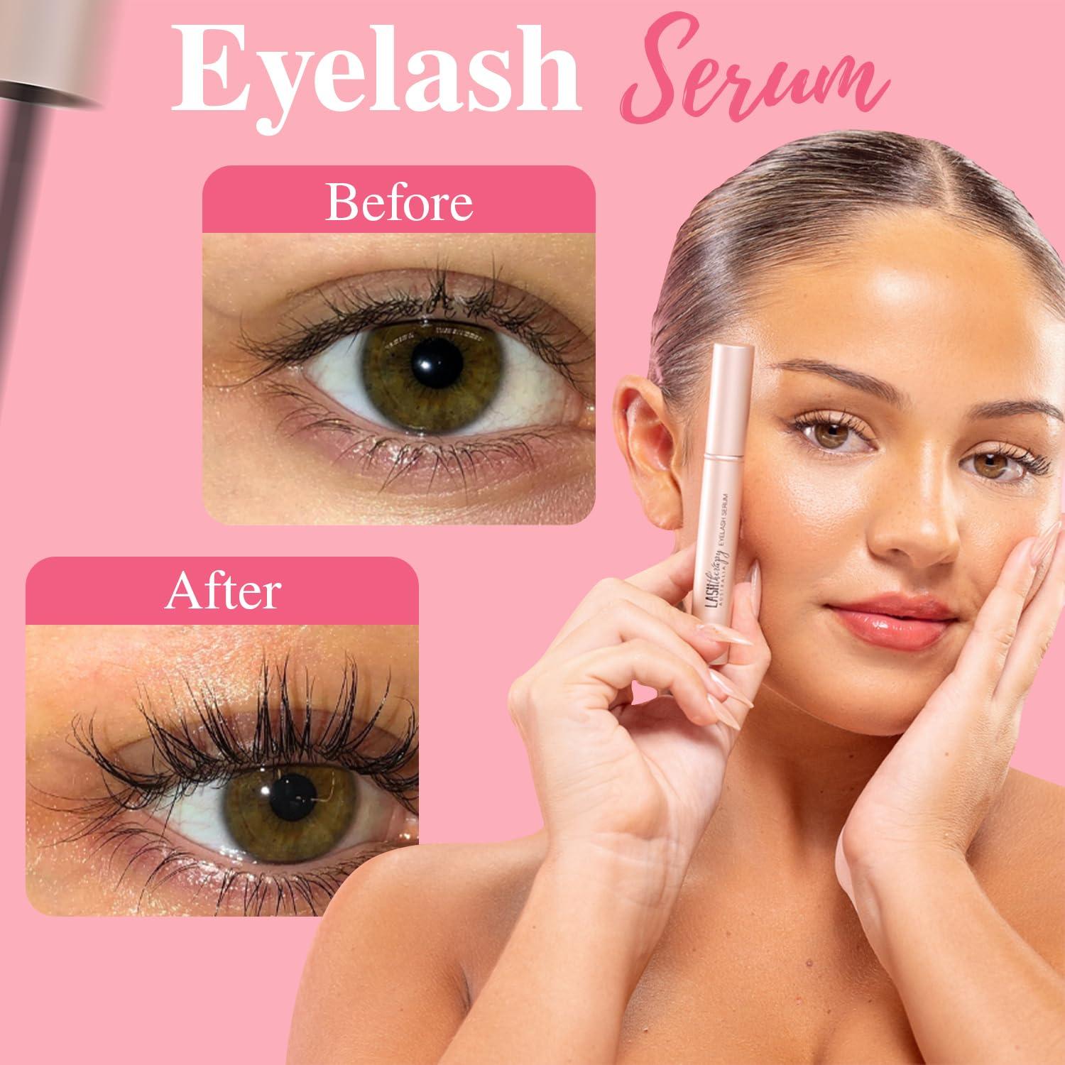 Lash Therapy Australia Lash Therapy Australia Lash Serum, Eyelash Growth Serum, Lash Growth Serum, Eyelash Serum To Grow Lashes, Lash Boost Serum, Lash Enhancing Serum, Cruelty Free, 3ml
