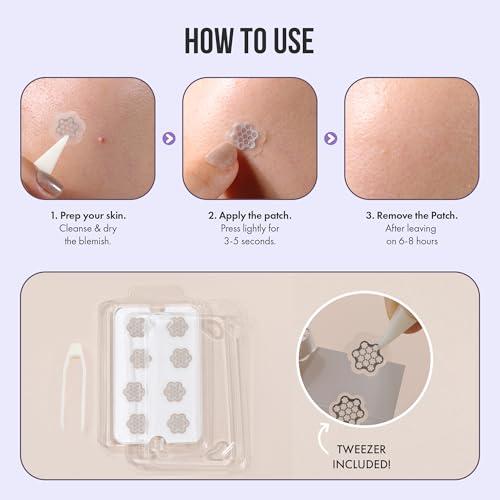 FreeGo Deep Blemish Microdarts | Pimple Patch | Cystic Acne | Fast-Acting | Quick Calming | 99.9% Pure Magnesium | Madecassic Acid | Tea Tree | Eucalyptus Leaf | Hydrocolloid Spot Care