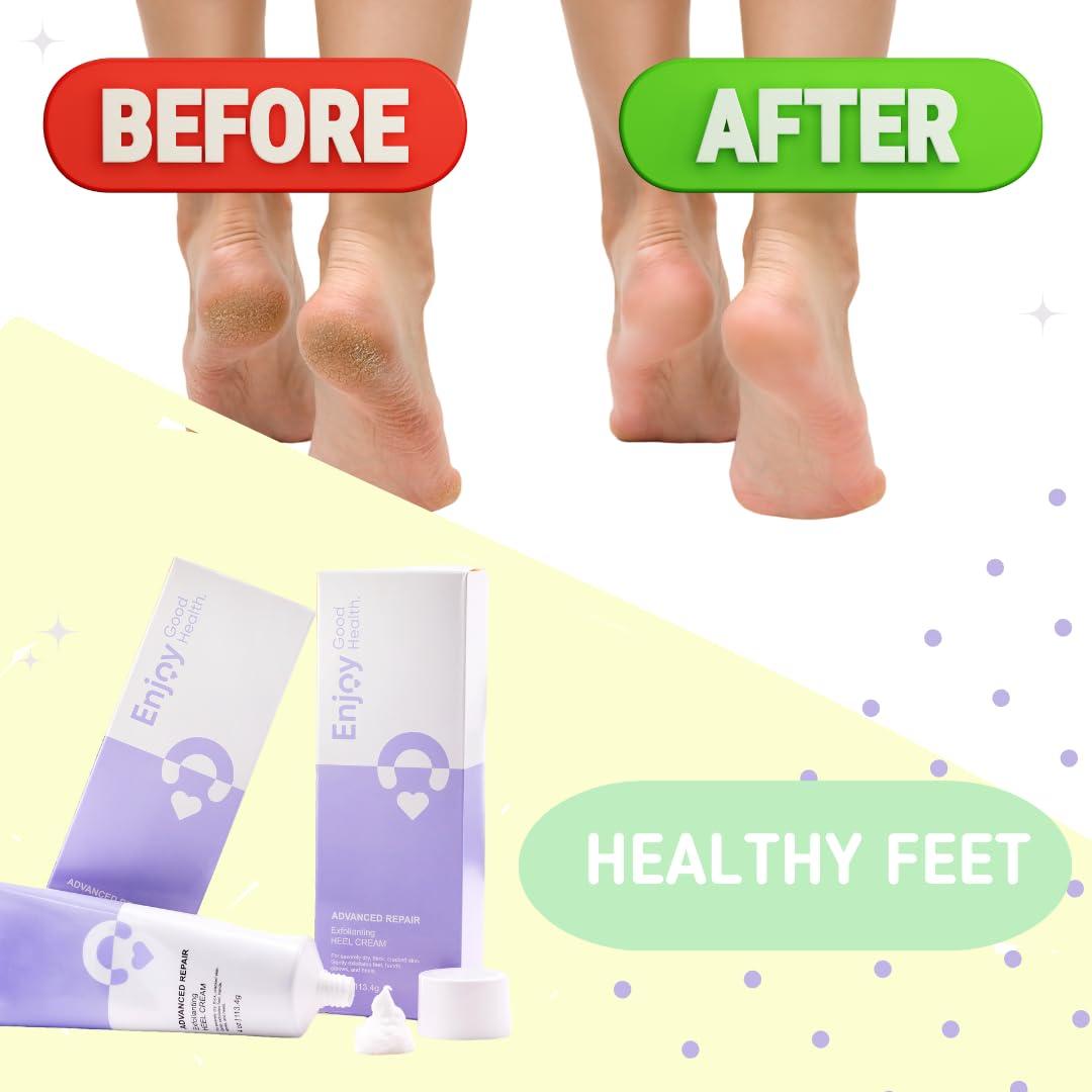Enjoy Good Health. Enjoy Good Health. Urea 40% Cream for Dry, Cracked, Rough Feet, Hands, Elbows, Knees. Softens calluses and repairs skin barriers. Moisturizes and Hydrates.