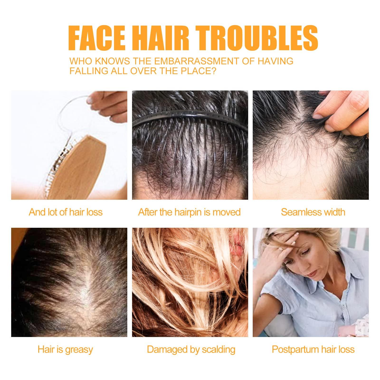 QINGTING 500ml Instant Ginger Hair Regrowth Shampoo, Ginger Shampoo, Ginger Shampoo for Hair Growth, Ginger Shampoo Hair Thickening Shampoo, Anti-Hair Loss (Shampoo)