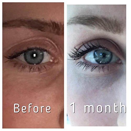 Pronexa Pronexa Hairgenics Lavish Lash (3ml, 3 Month Supply) Eyelash Growth Enhancer & Brow Serum with Natural Peptides for Long, Thick Lashes and Eyebrows! Dermatologist Certified & Hypoallergenic.