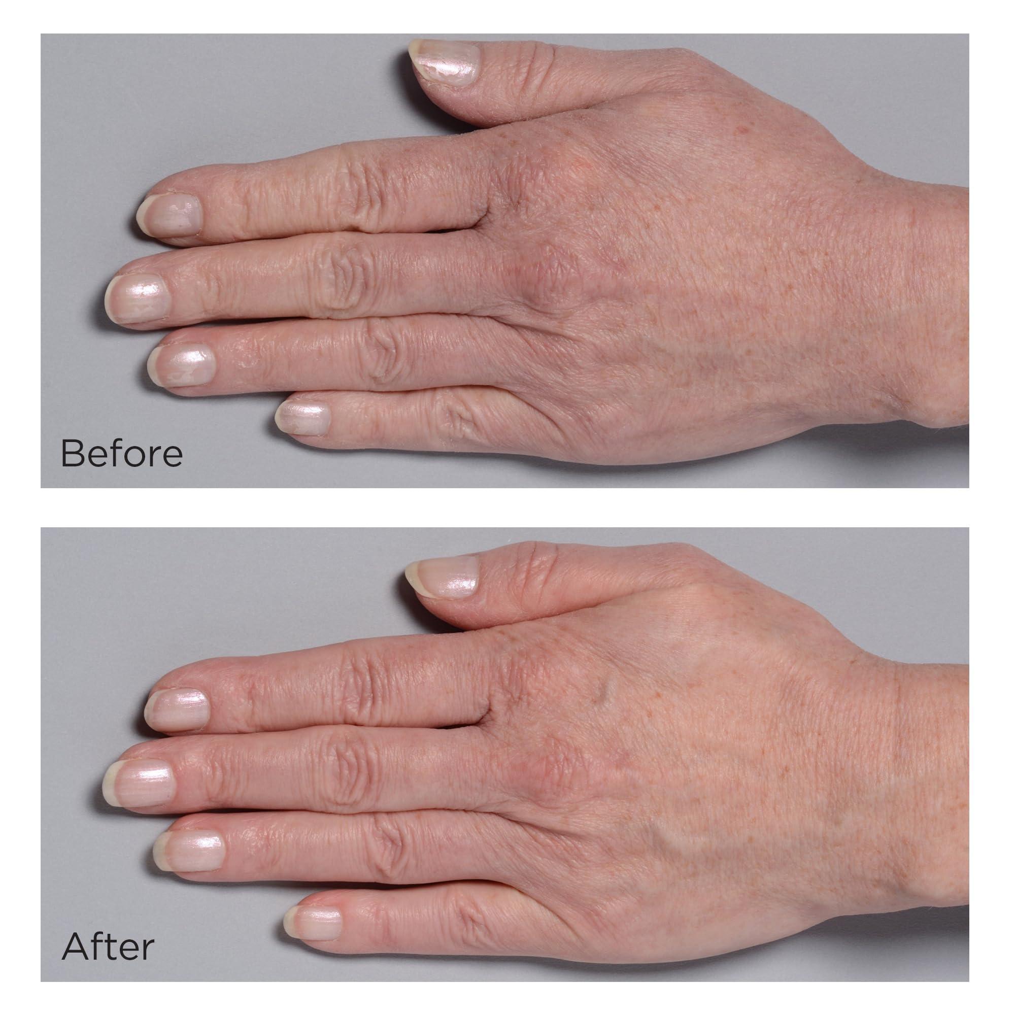 Perricone MD Perricone MD Cold Plasma Plus+ Hand Therapy, 2 fl. oz.