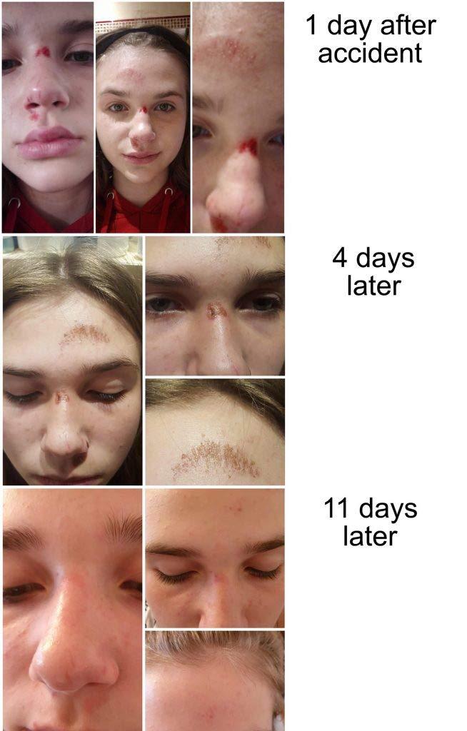 RAVIAD Natura Resort AMAZON Arkada TC16 Serum