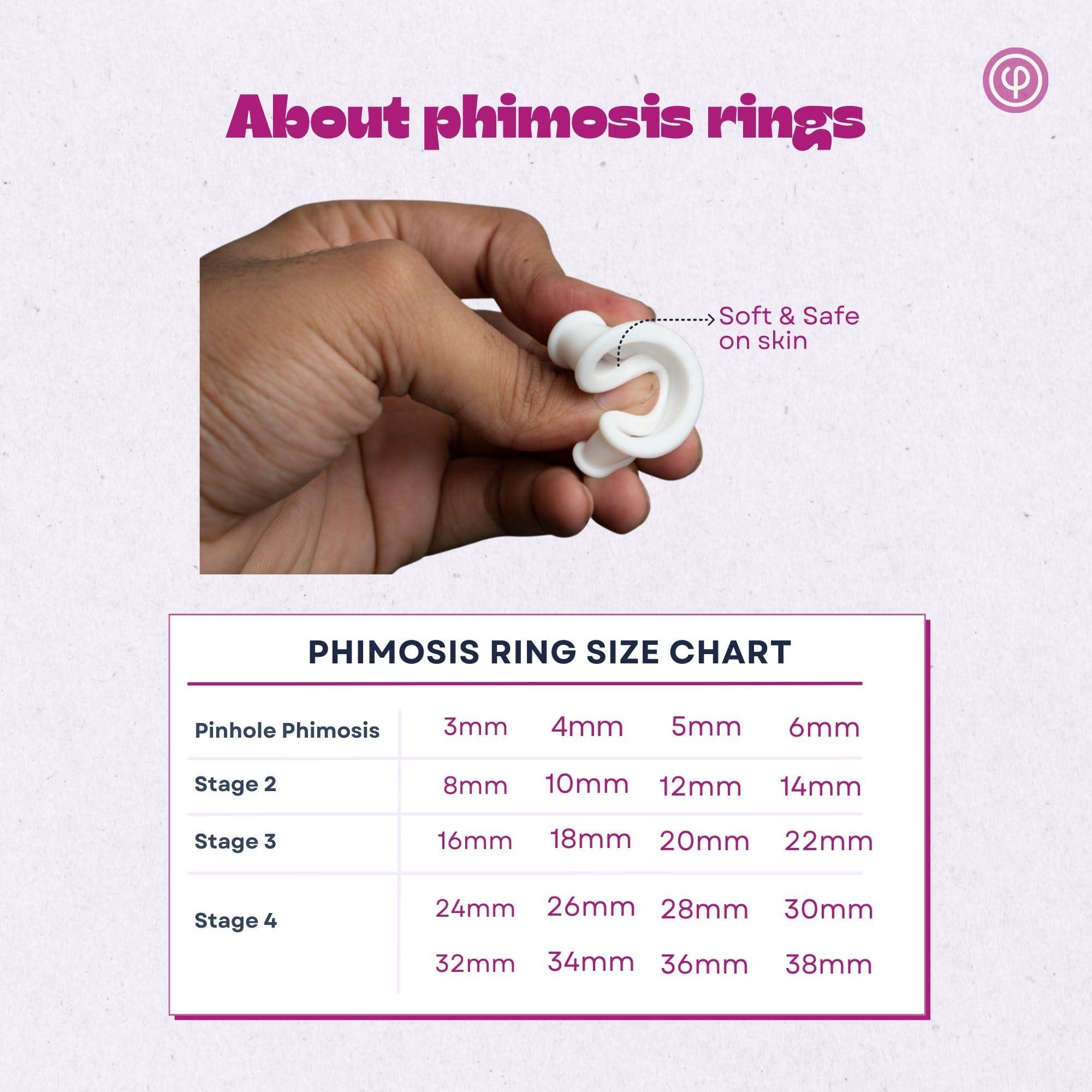 VAJRAANG Vajraang Phimosis Stretching Rings Kit, Ring Removal Tool And User Manual | Includes 20 Graduated Rings | Fast Results | No-Side-Effects (With Phimosis Cream)