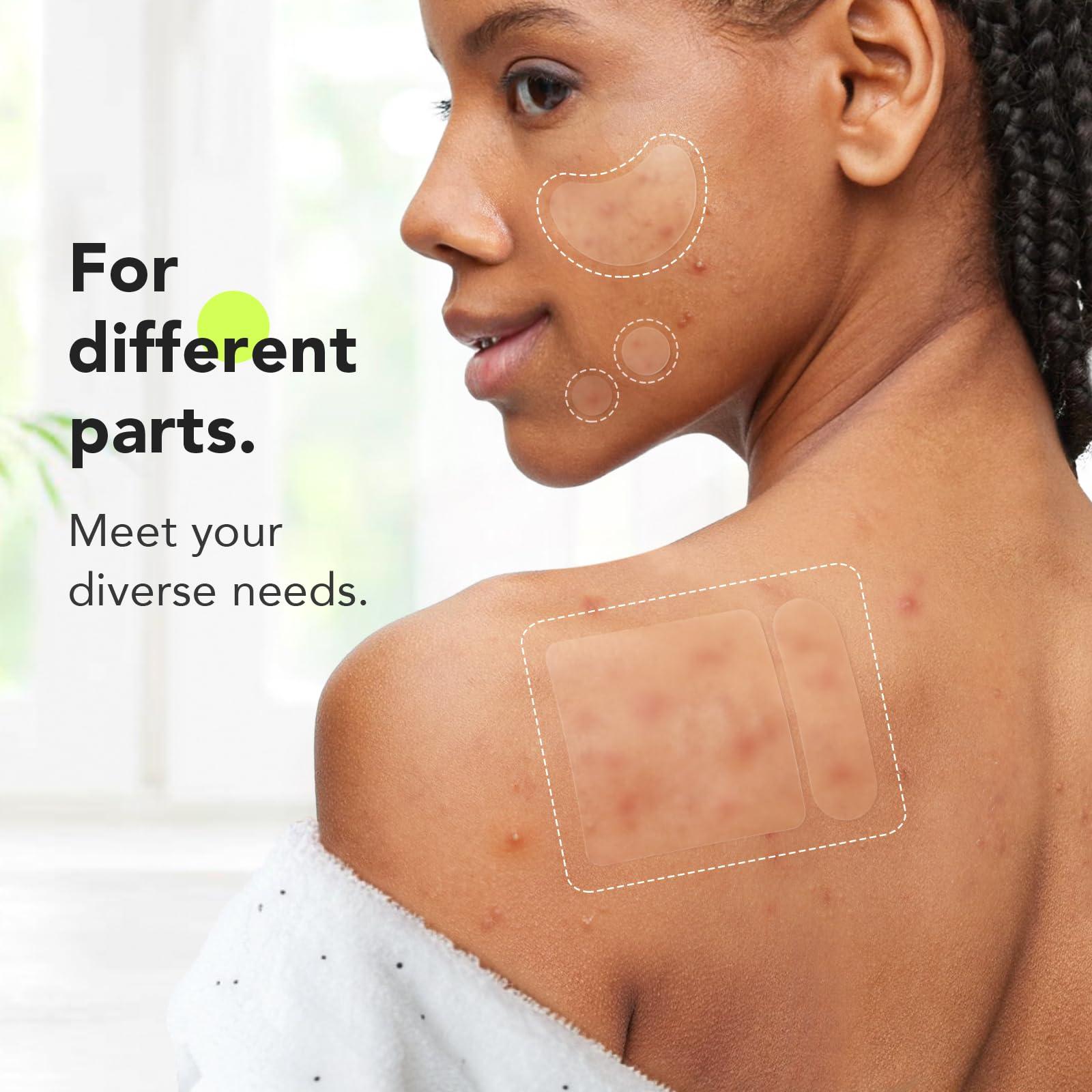 LitBear LitBear Large Pimple Patches (7 Sizes 112 Patches), Big Acne Patches, XL Hydrocolloid Bandages for Full Face, Forehead, Chin, Nose, Body, Back, Neck & Chest, Oval, Moon, Square hydrocolloid Patch