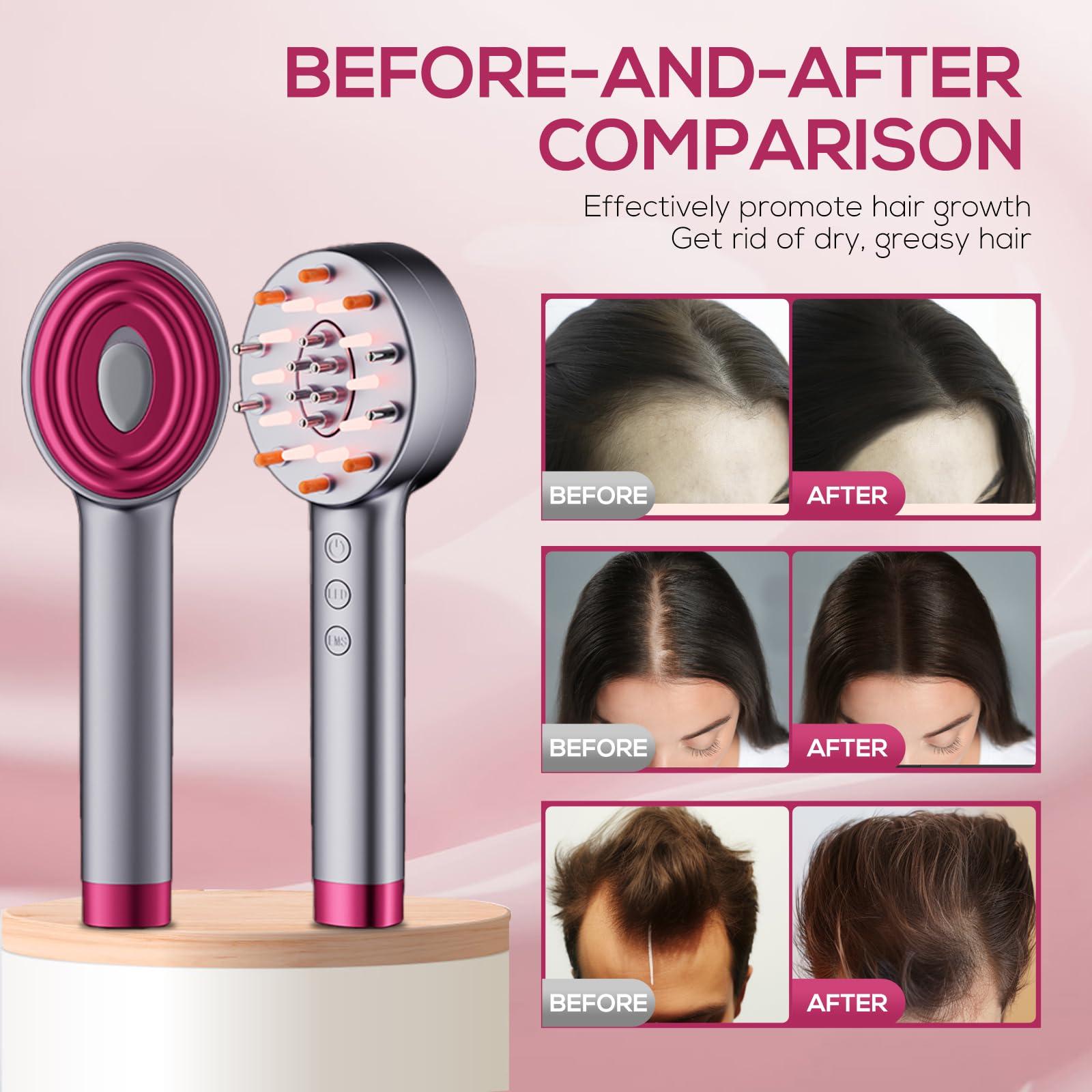 Kadielona Laser Hair Growth Comb, Laser Comb Laser Hair Growth Device Electric Scalp Massager for Hair Growth,Stimulates Hair Growth Comb Brush Thinning Hair Treatment Laser Therapy Comb