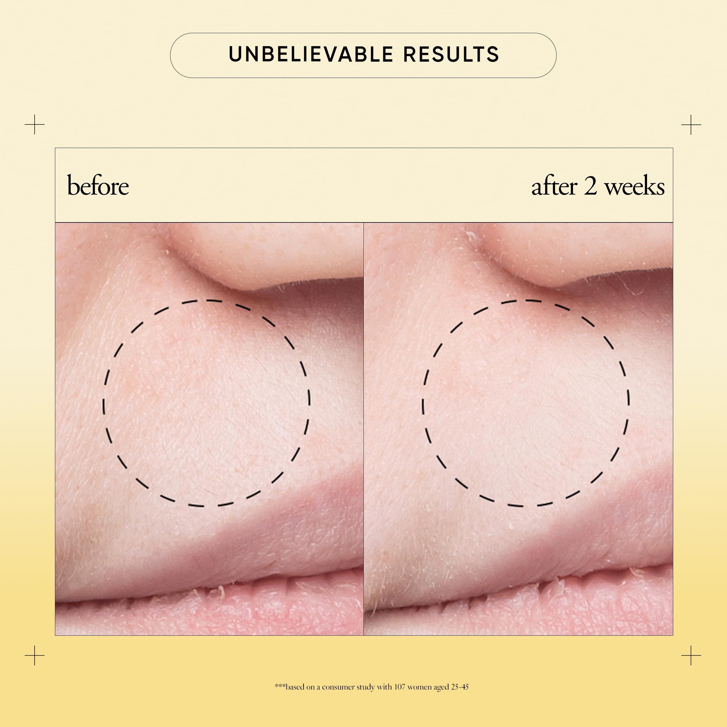 philosophy philosophy purity made simple pore extractor mask