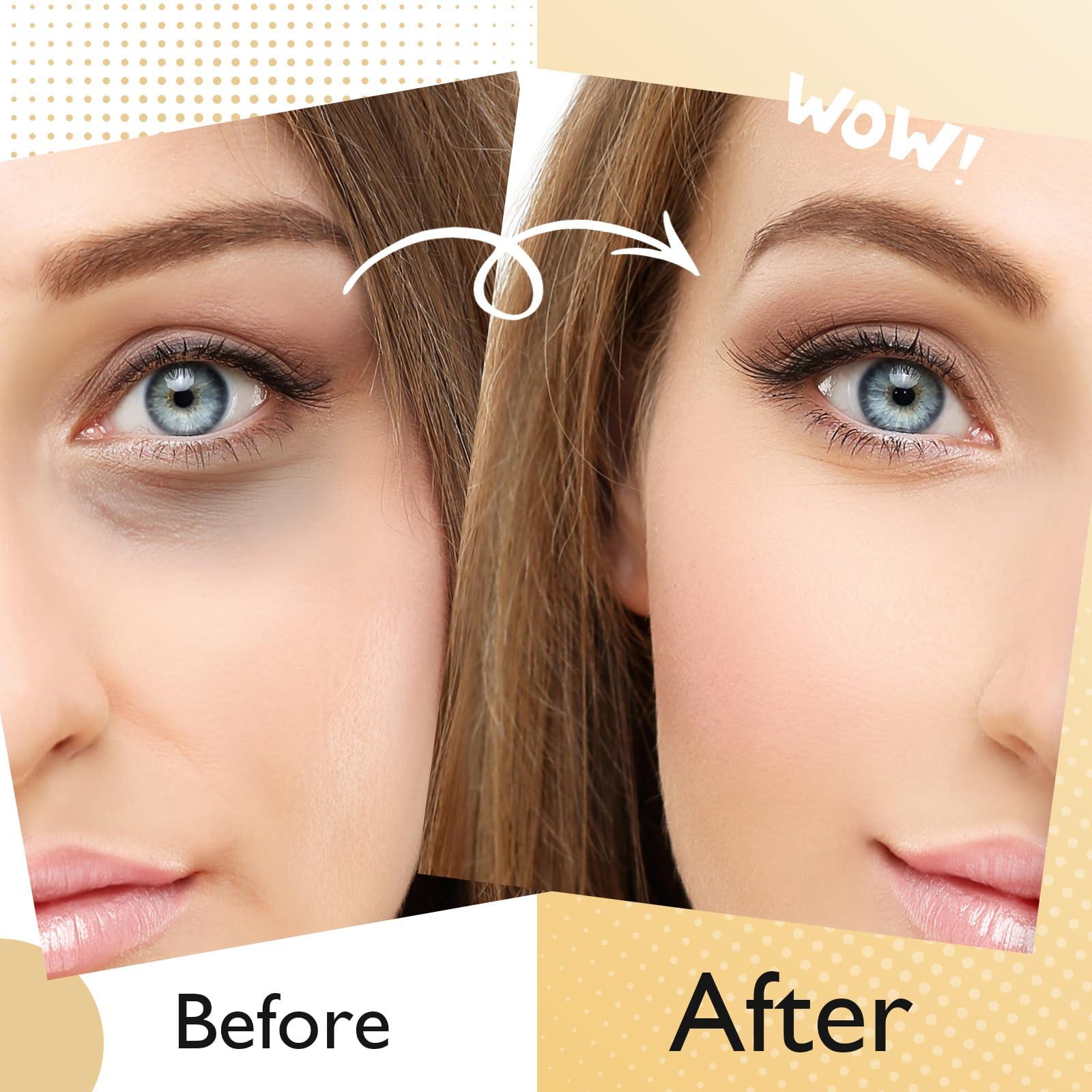 Adofect Adofect 25 Paris Under Eye Patches 24k Gold Under Eye Mask for Puffy Eyes and Dark Circles Treatments, Under Eye Bags Treatment Collagen Gel Pads for Beauty & Personal Care, Gold