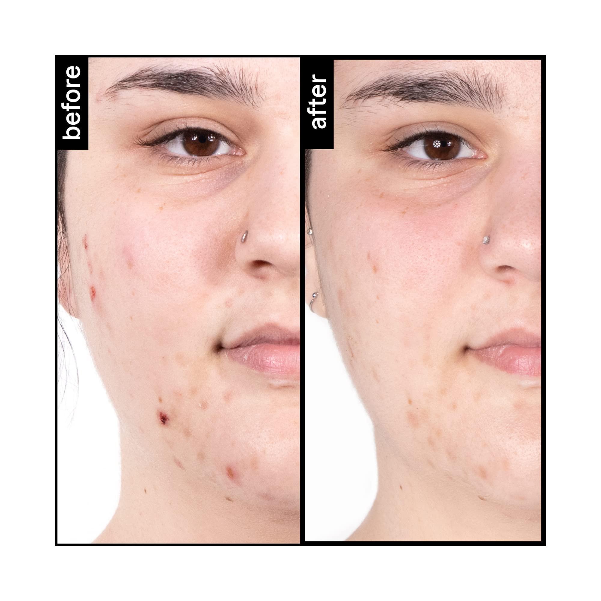 pH-In pH-In The Cleanser