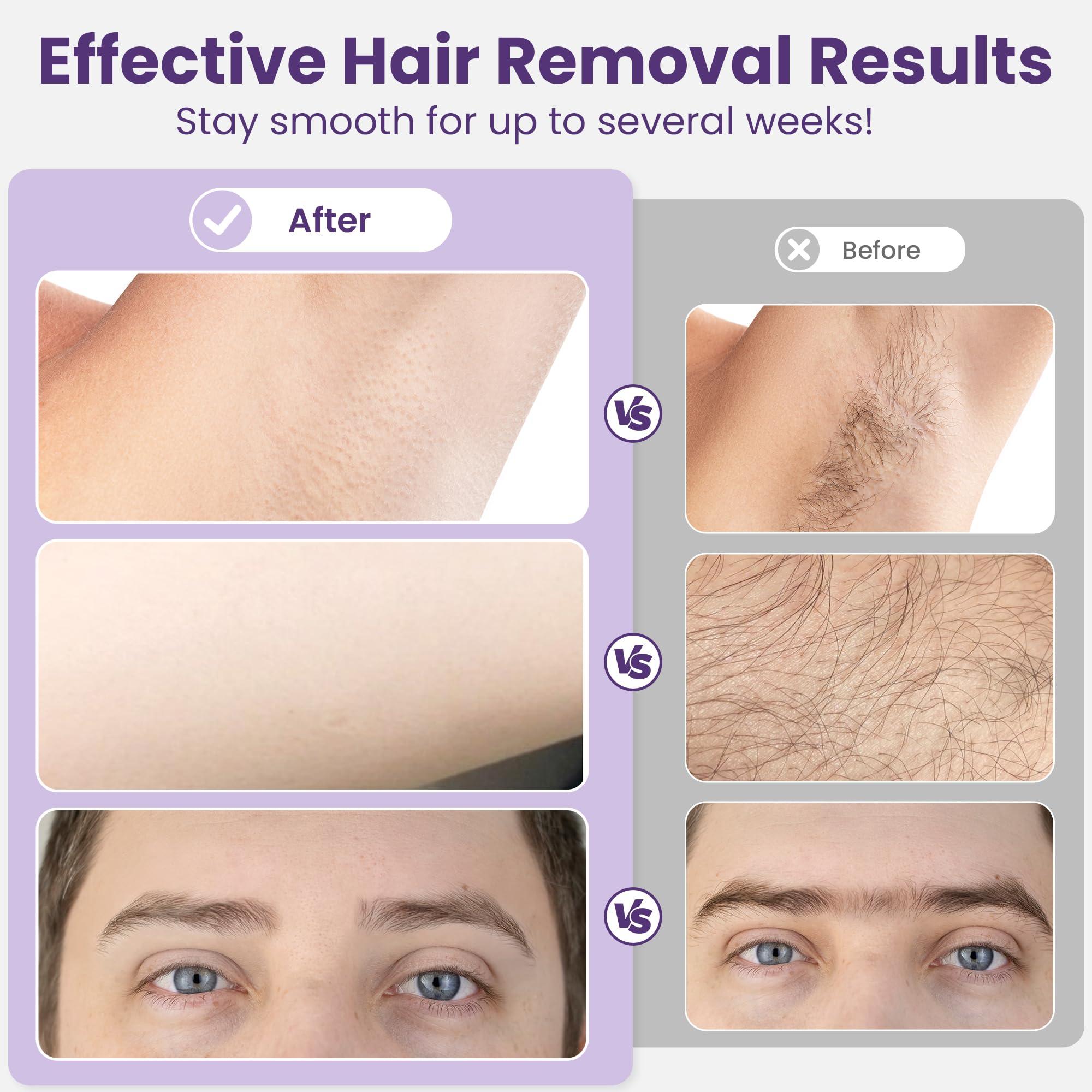 Sunvivi Sunvivi Wax Kit Digital Hair Removal Waxing Kit for Women & Men, Hot Wax Warmer Pot with 5 Bag Hard Wax Beads, Wax Melt Warmer Kit for Full Body, Legs, Face, Bikini,Sensitive skin, Pink