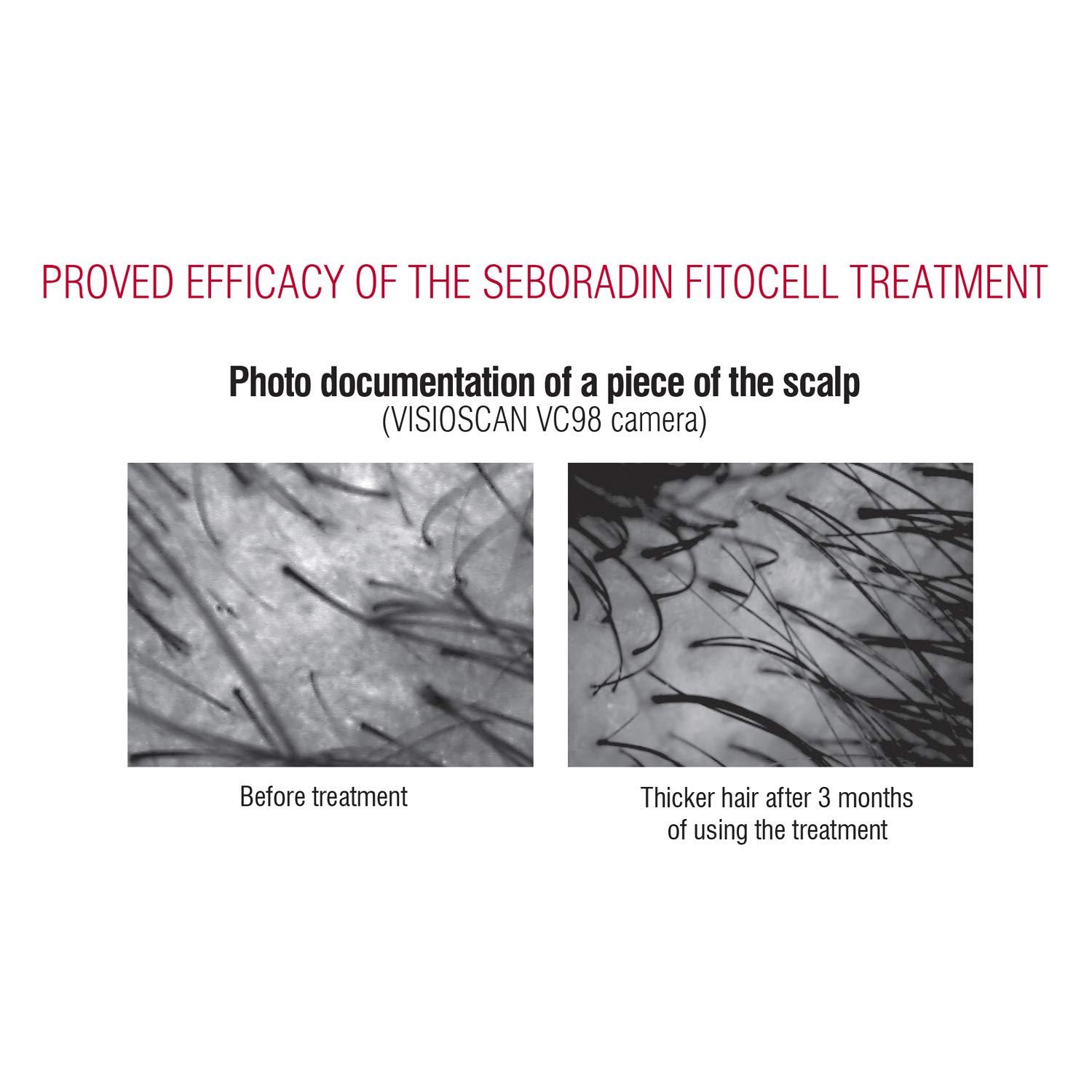 SEBORADIN Seboradin Hair Loss and regrowth Fitocell Shampoo with Swiss Technology Stem Cells Phytocelltec Malus Domestica and Biotin, for Men and Women, 200 ml