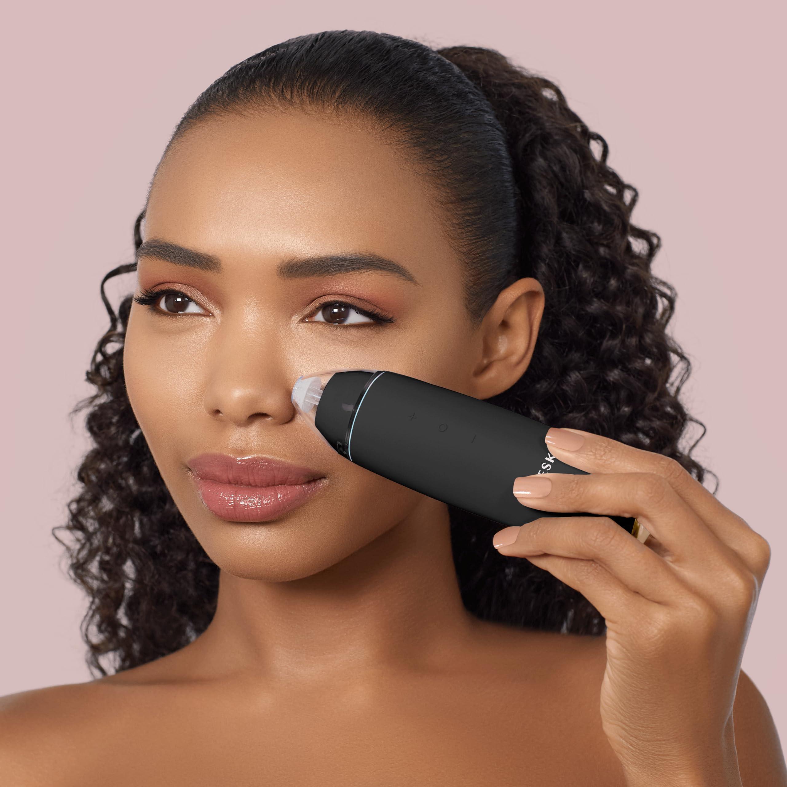 GESKE GESKE SmartAppGuided MicroDermabrasion Blackhead Remover | 7 in 1 | Blackhead Remover | Electric Pore Cleaner | Innovative Vacuum Cup | Beauty Tool | Skin Cleansing Device | Skincare Device